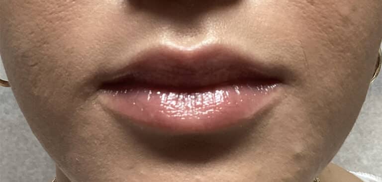 After Image: Lip Flip - front