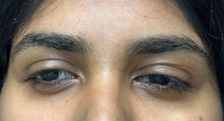 Before Image: Lash Lift and Brow Lamination - front